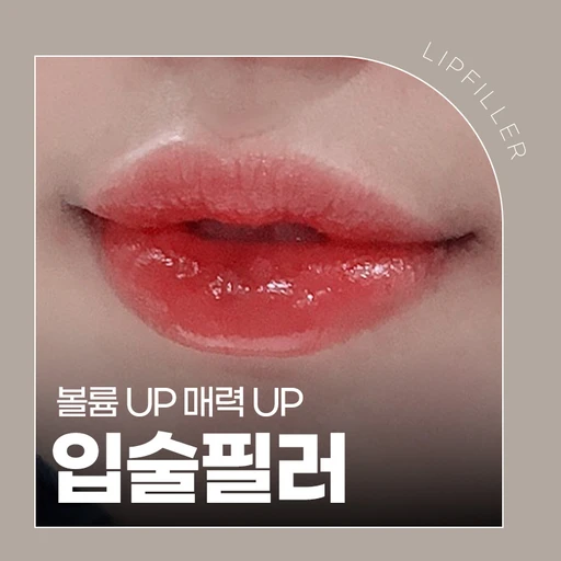 treatment-event-thumbnail