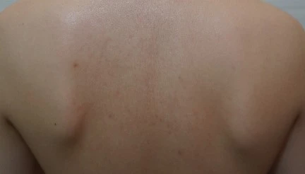 before_image