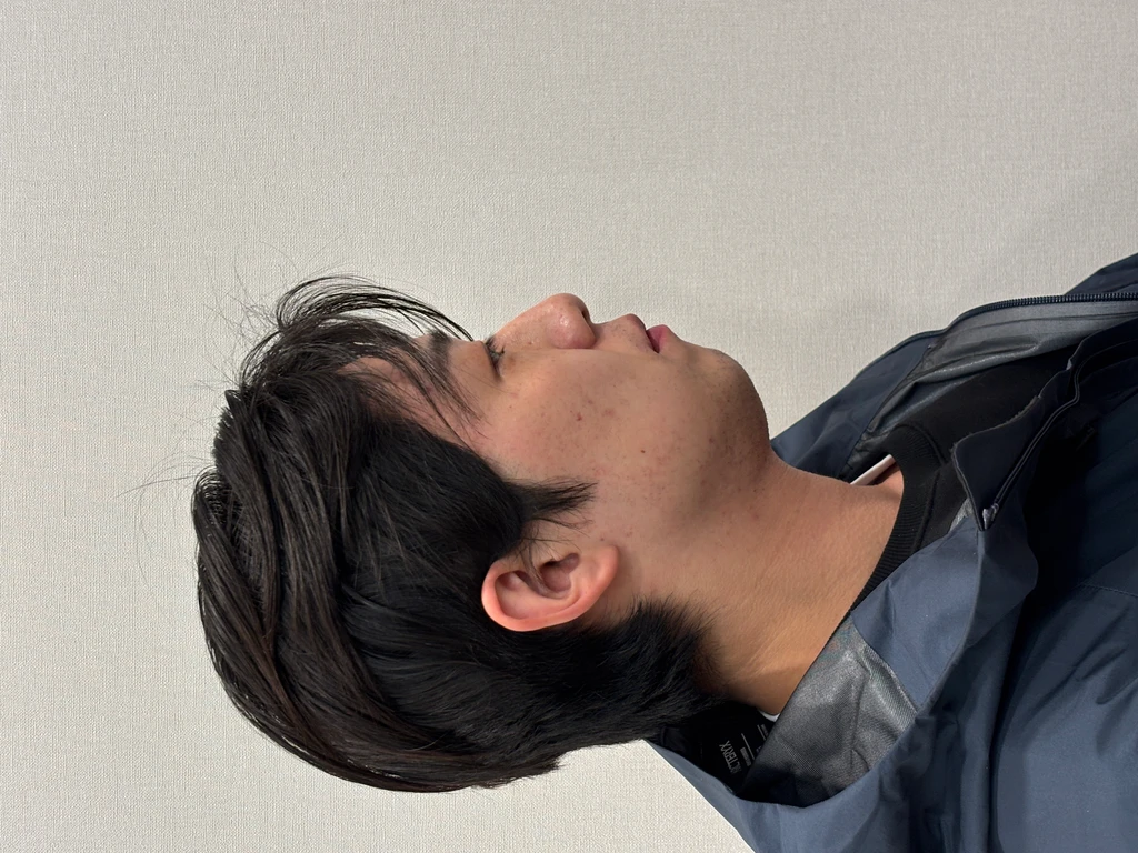 before_image