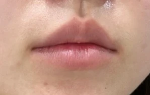 before_image