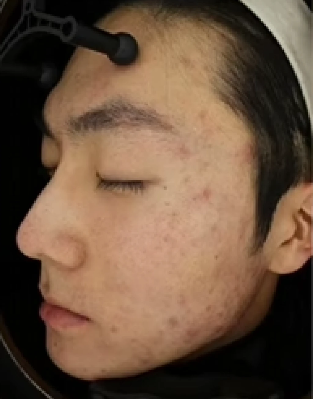before_image