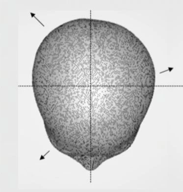 before_image
