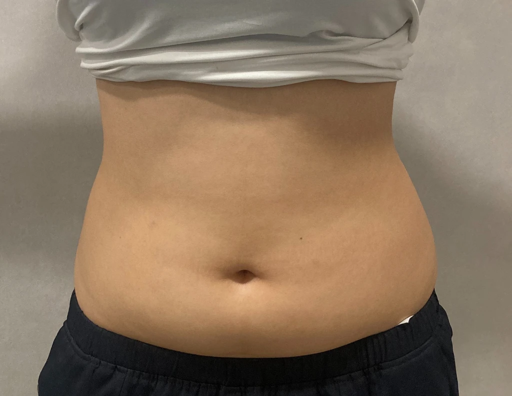 before_image
