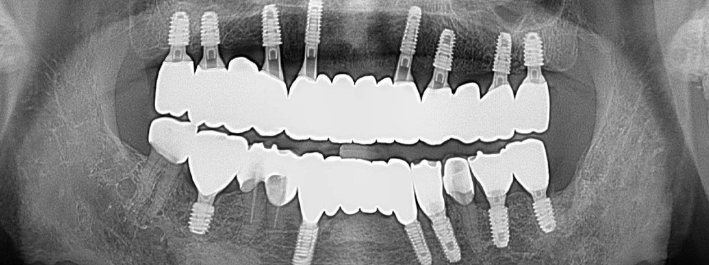 before_image