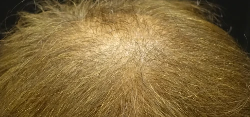 before_image