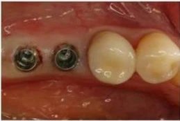 before_image