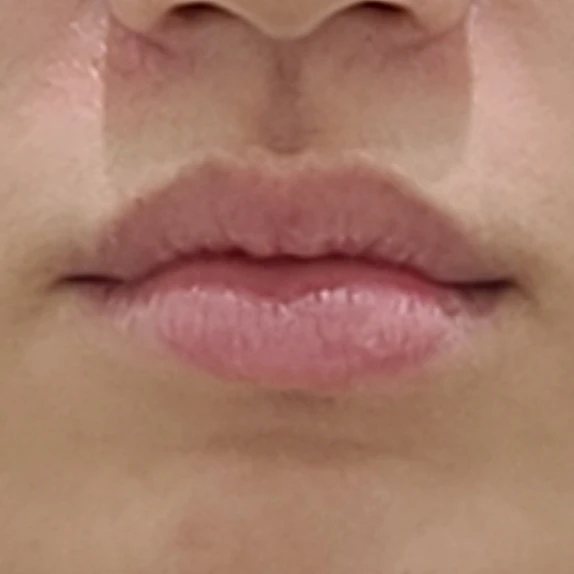 before_image