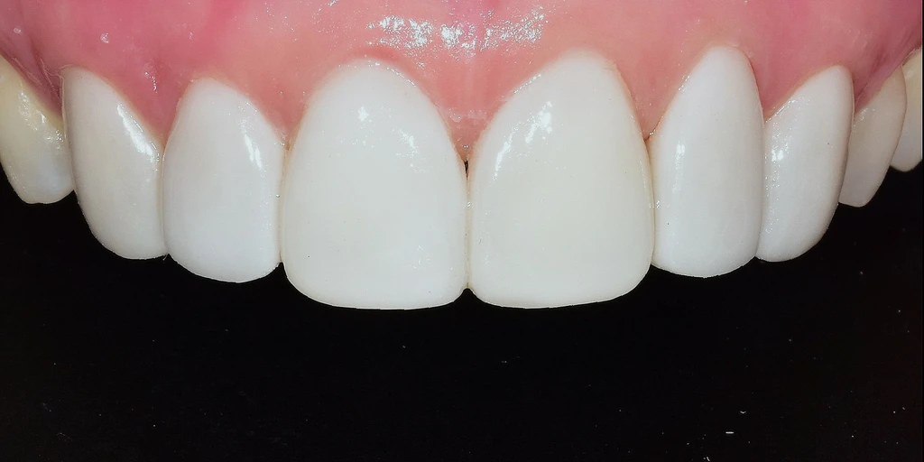 before_image