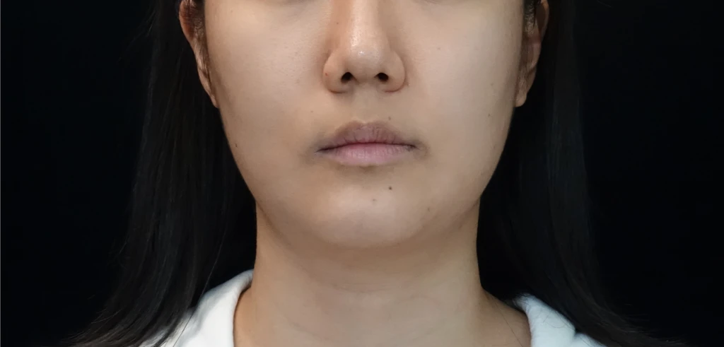 before_image