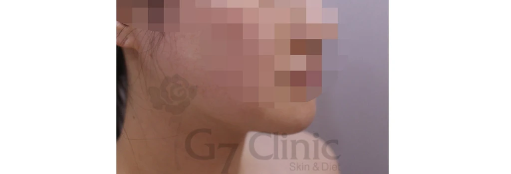 before_image
