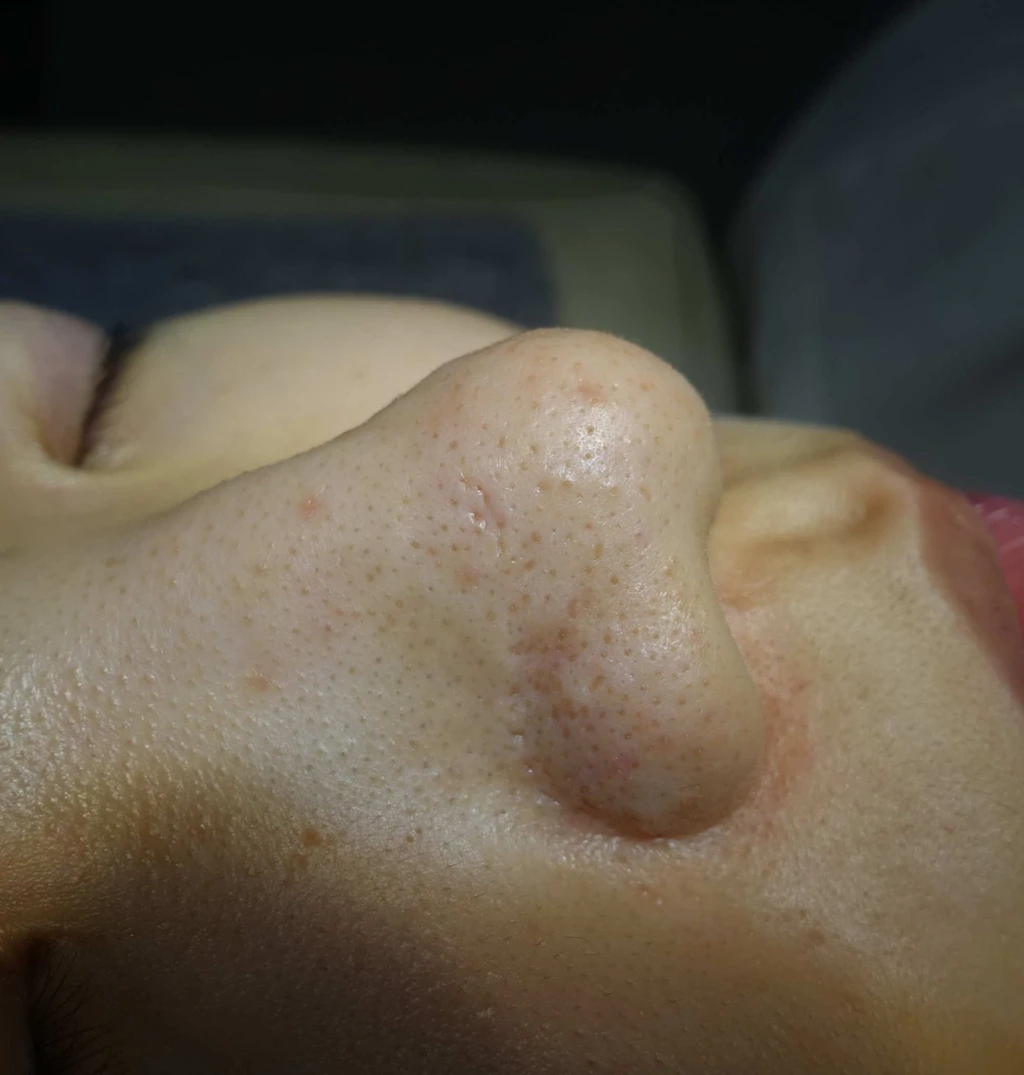 before_image
