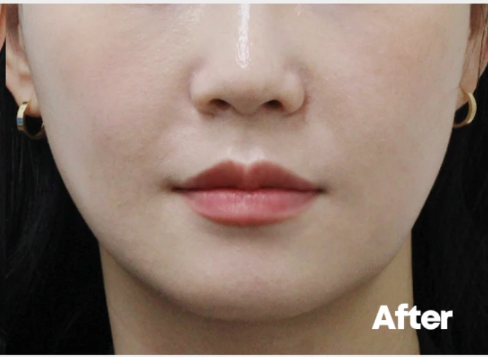 before_image