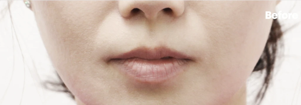 before_image