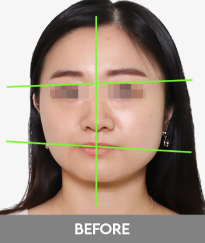 before_image