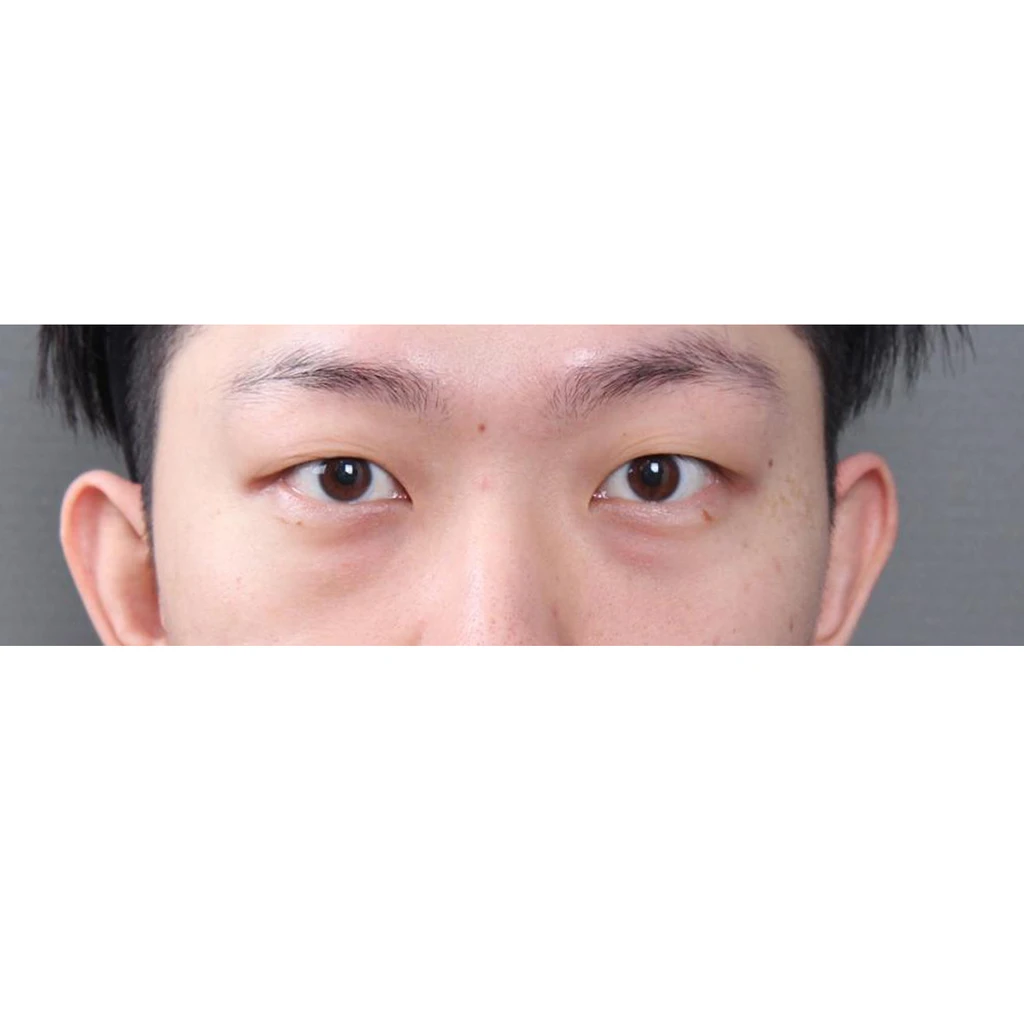 before_image
