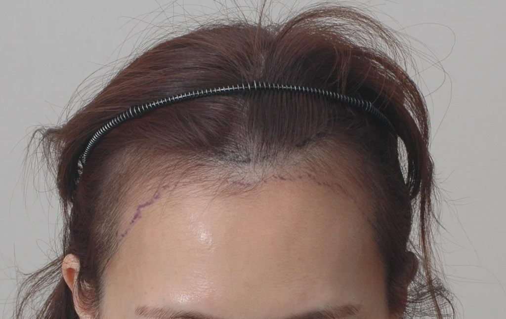 before_image