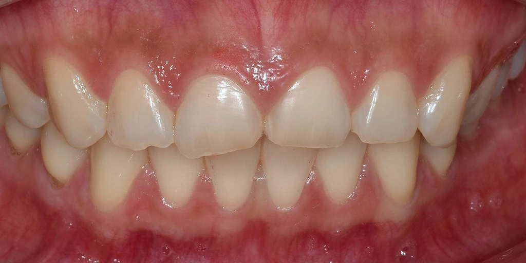 before_image