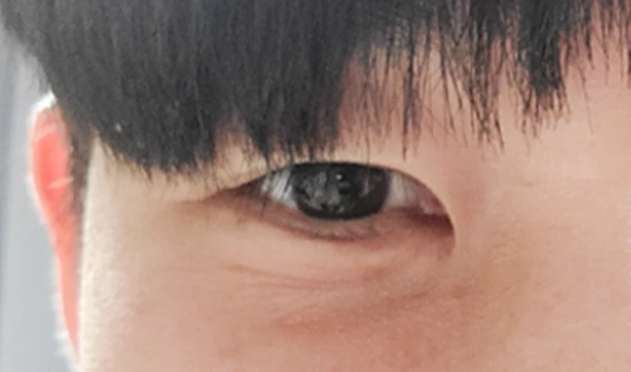 before_image