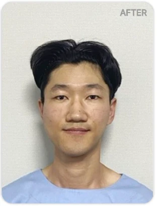 before_image