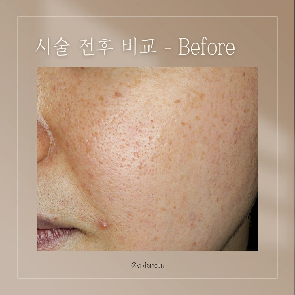 before_image
