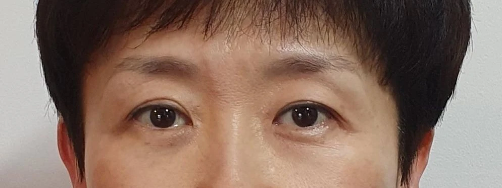 before_image