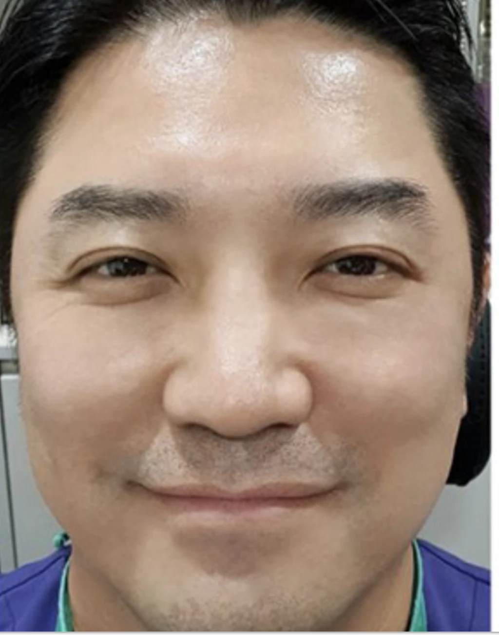 before_image