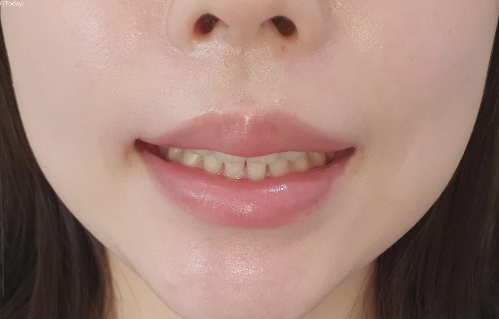 before_image