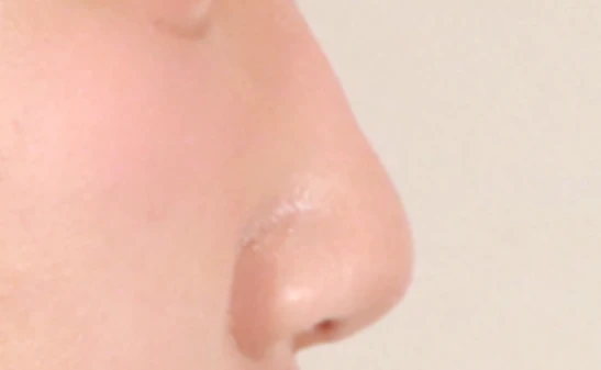 before_image