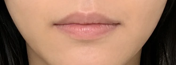 before_image