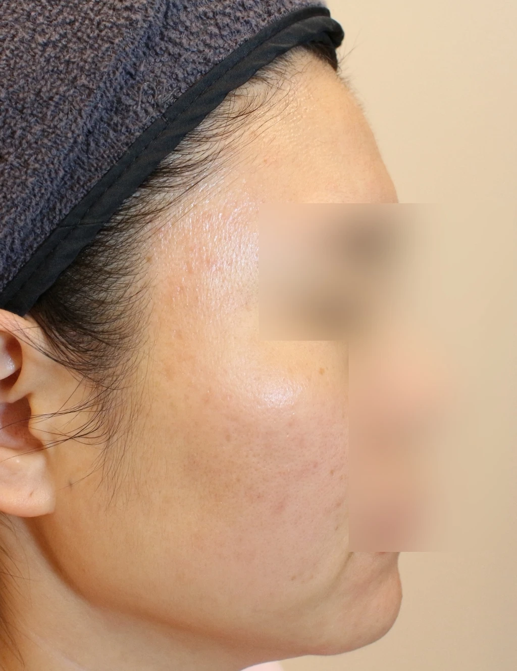 before_image