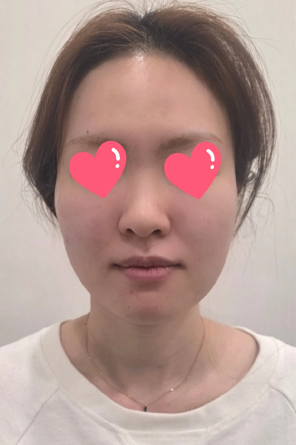 before_image