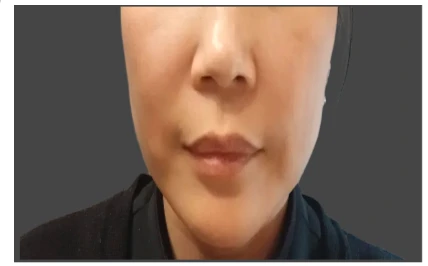 before_image
