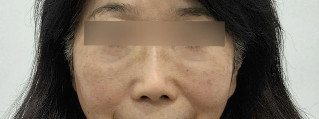 before_image