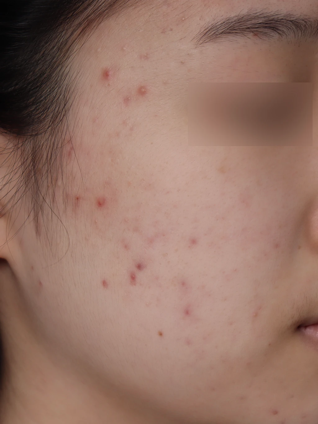 before_image