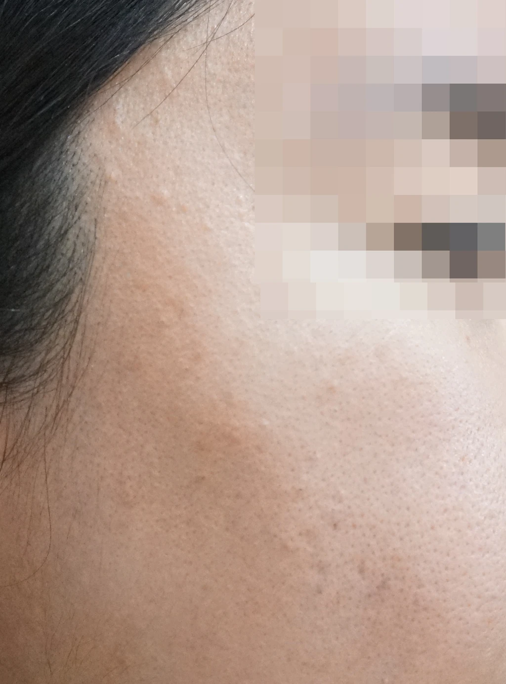 before_image