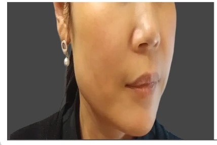 before_image
