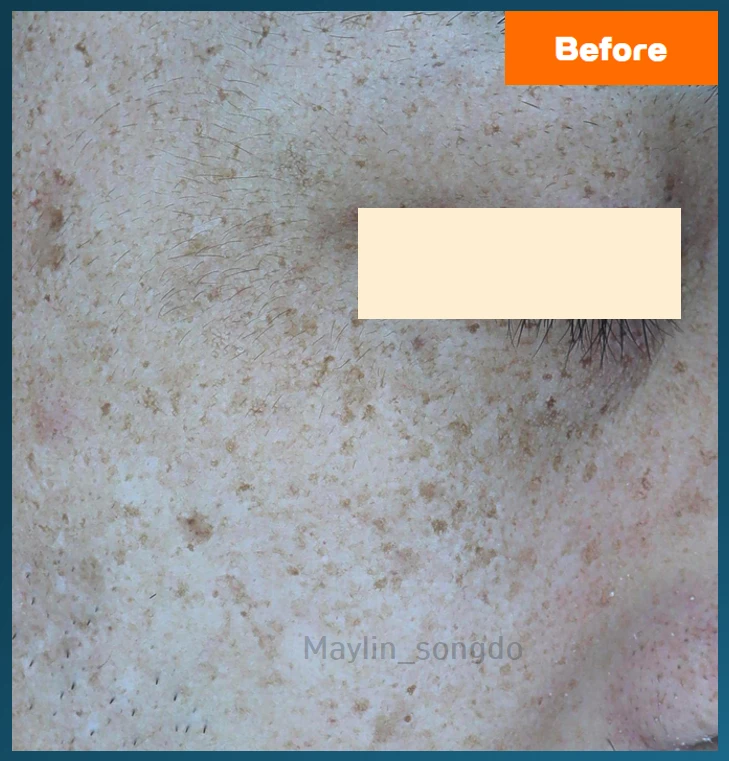 before_image