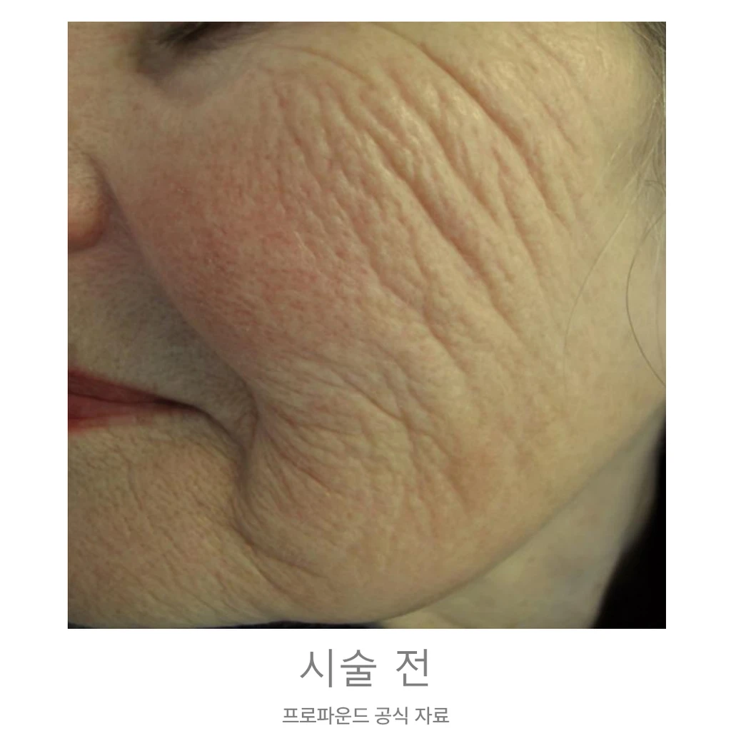 before_image