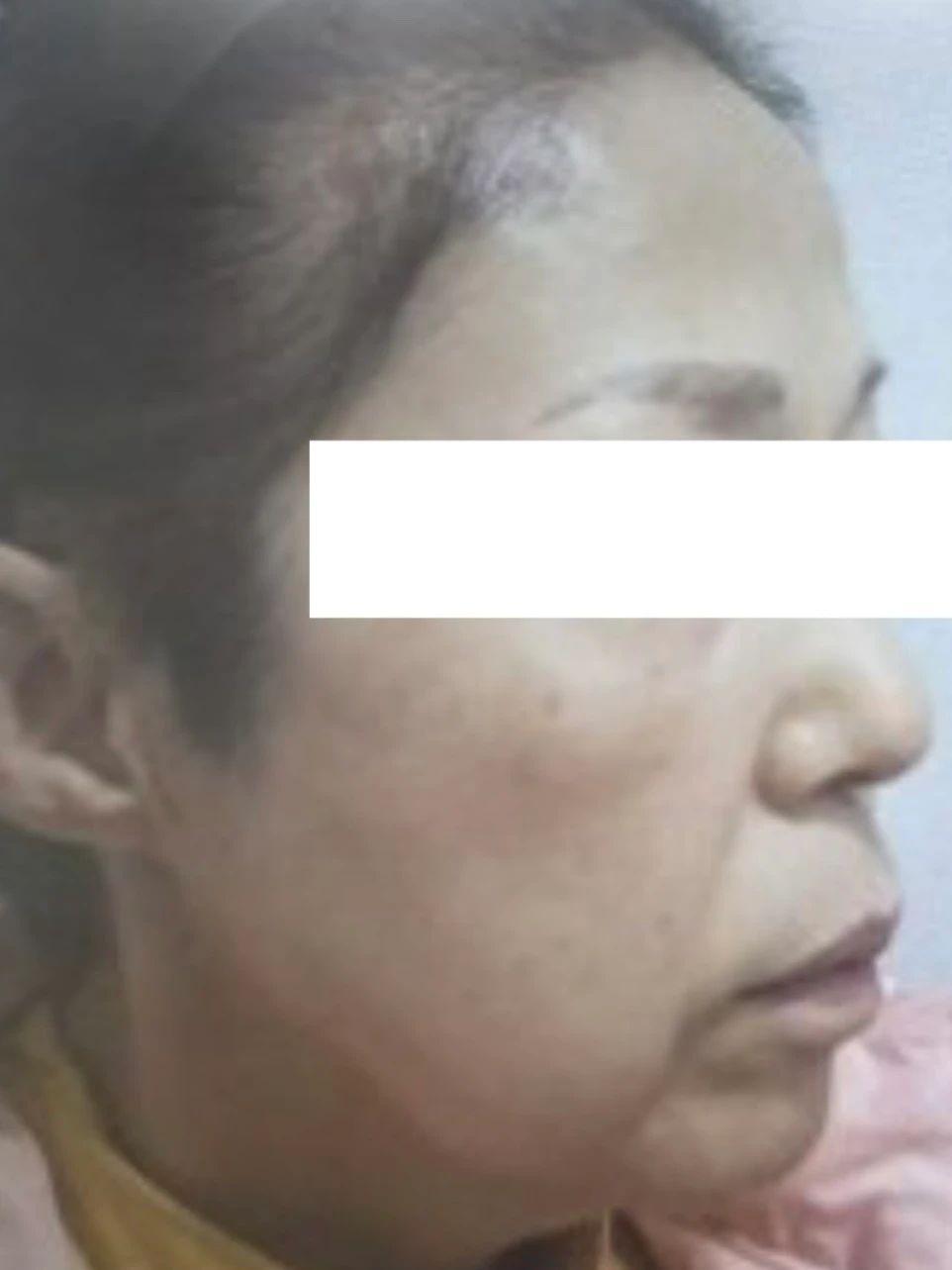 before_image