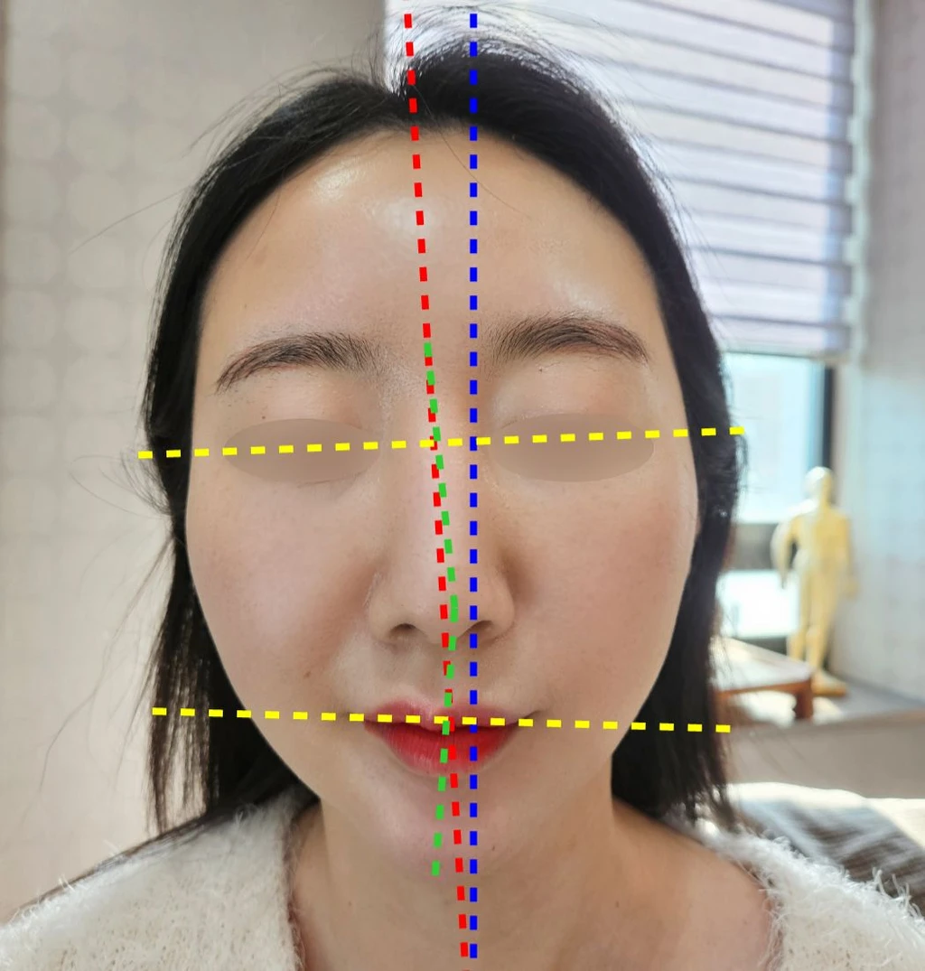 before_image