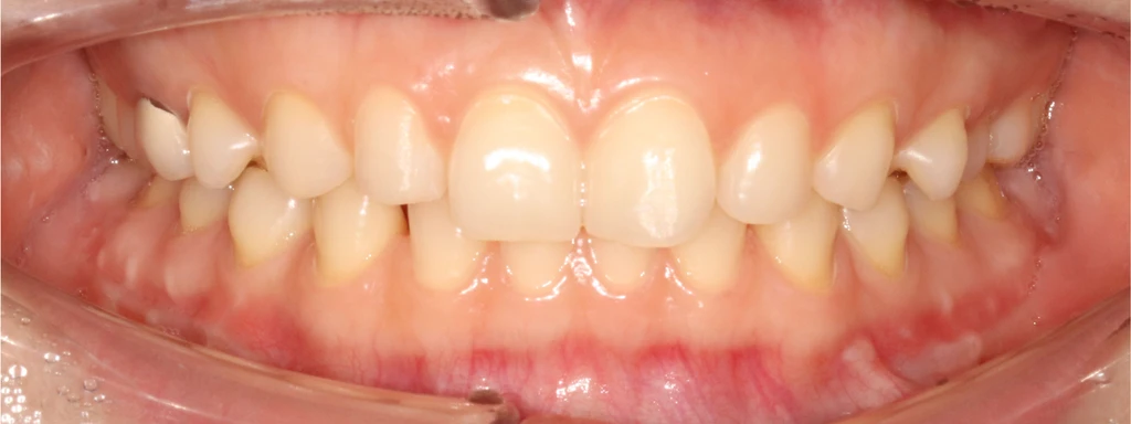 before_image