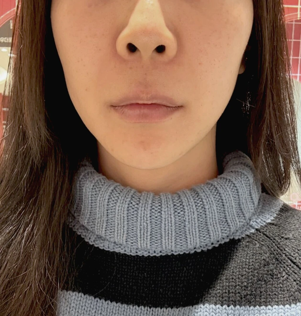 before_image