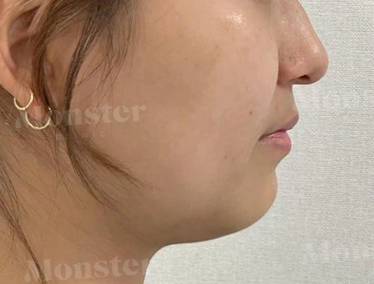 before_image