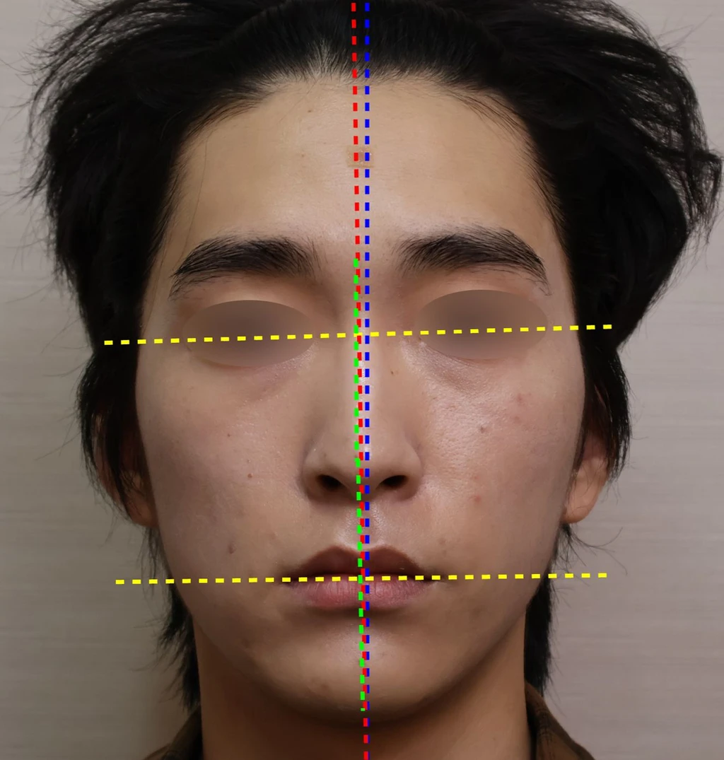 before_image