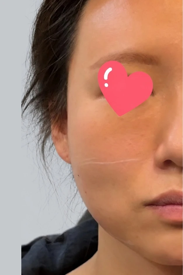 before_image