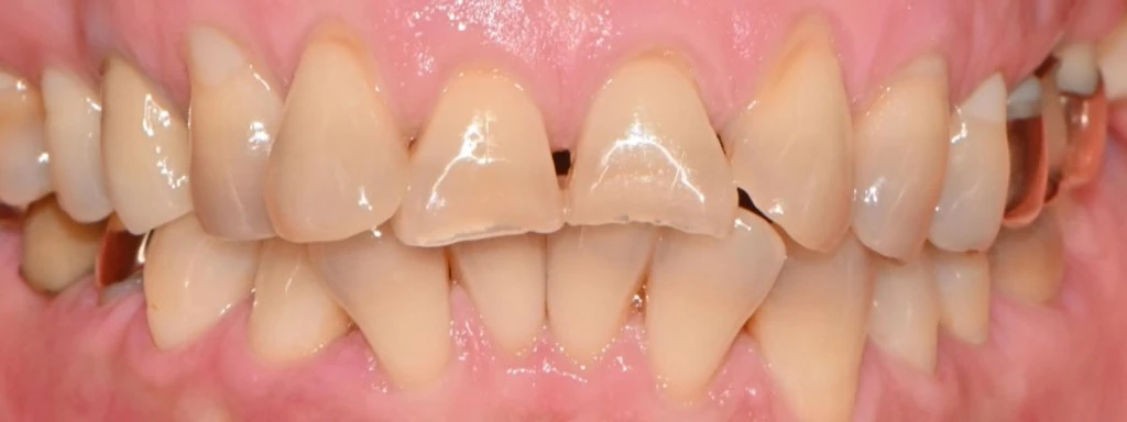 before_image