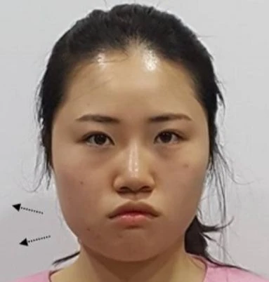 before_image