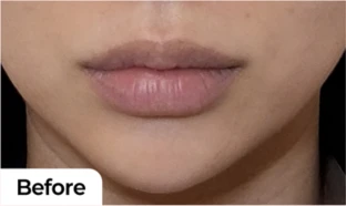 before_image