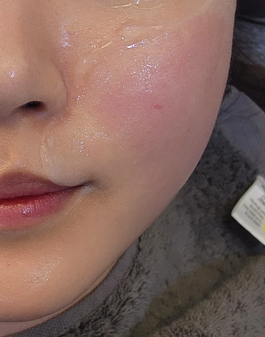 before_image