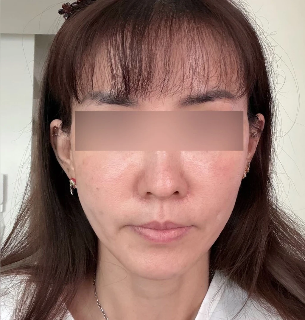 before_image